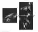 Fig. 06 - METHOD OF INHIBITING ANGIOGENESIS, TUMORIGENESIS AND CATHEPSIN ACTIVITY