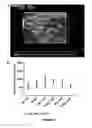 Fig. 09 - HEART FAILURE TREATMENT