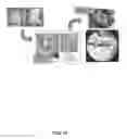 Fig. 12 - Composition and methods for treating ischemic damage