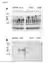 Fig. 06 - NEISSERIAL VACCINE COMPOSITIONS COMPRISING A COMBINATION OF ANTIGENS