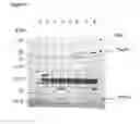 Fig. 12 - NEISSERIAL VACCINE COMPOSITIONS COMPRISING A COMBINATION OF ANTIGENS
