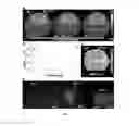 Fig. 16 - CHEMICAL EXCHANGE SATURATION TRANSFER (CEST) BASED MRI USING REPORTER GENES AND SUBSTRATES AND METHODS THEREOF
