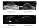 Fig. 14 - Nanoparticle Photoacoustic Imaging Agents