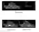 Fig. 15 - Nanoparticle Photoacoustic Imaging Agents
