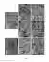 Fig. 17 - Implants for inducing soft and hard tissue integration