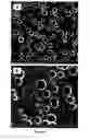 Fig. 05 - Peripheral nerve growth conduit