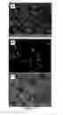Fig. 13 - Peripheral nerve growth conduit