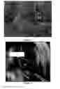 Fig. 14 - Peripheral nerve growth conduit