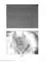 Fig. 05 - Antibacterial cornea repair material and preparation method thereof