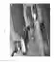 Fig. 02 - Cellular transplant site