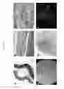 Fig. 12 - Cellular transplant site
