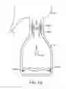 Fig. 17 - Quantification and inventory management of expressed human breast milk
