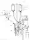 Fig. 01 - Percutaneous heart pump