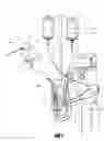 Fig. 02 - Percutaneous heart pump
