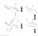 Fig. 14 - Percutaneous heart pump