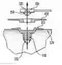 Fig. 01 - Implanted device with wireless energy transfer and external alignment feature