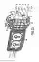 Fig. 53 - Medical treatment system and methods using a plurality of fluid lines
