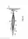 Fig. 68 - Medical treatment system and methods using a plurality of fluid lines