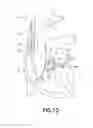 Fig. 09 - Dual lumen cannula