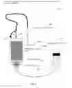 Fig. 05 - Wearable hemoperfusion device
