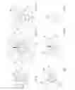 Fig. 09 - ANGIOGRAPHIC METHODS FOR IDENTIFICATION OF FEEDER VESSELS