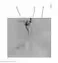 Fig. 20 - ANGIOGRAPHIC METHODS FOR IDENTIFICATION OF FEEDER VESSELS