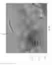 Fig. 22 - ANGIOGRAPHIC METHODS FOR IDENTIFICATION OF FEEDER VESSELS