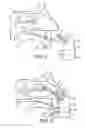 Fig. 04 - Delivery Device and Method