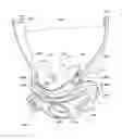 Fig. 01 - ORO-NASAL PATIENT INTERFACE