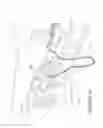 Fig. 02 - ORO-NASAL PATIENT INTERFACE