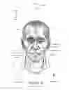 Fig. 07 - ORO-NASAL PATIENT INTERFACE