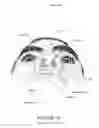 Fig. 10 - ORO-NASAL PATIENT INTERFACE