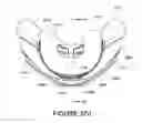Fig. 136 - ORO-NASAL PATIENT INTERFACE