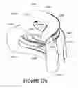 Fig. 137 - ORO-NASAL PATIENT INTERFACE