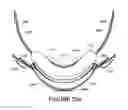 Fig. 147 - ORO-NASAL PATIENT INTERFACE