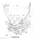 Fig. 15 - ORO-NASAL PATIENT INTERFACE