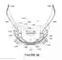 Fig. 17 - ORO-NASAL PATIENT INTERFACE