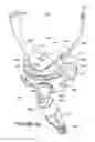 Fig. 20 - ORO-NASAL PATIENT INTERFACE
