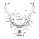 Fig. 22 - ORO-NASAL PATIENT INTERFACE