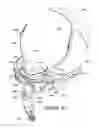 Fig. 25 - ORO-NASAL PATIENT INTERFACE