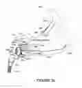 Fig. 27 - ORO-NASAL PATIENT INTERFACE