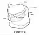 Fig. 30 - ORO-NASAL PATIENT INTERFACE