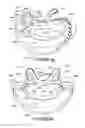 Fig. 46 - ORO-NASAL PATIENT INTERFACE