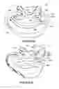 Fig. 47 - ORO-NASAL PATIENT INTERFACE