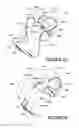 Fig. 48 - ORO-NASAL PATIENT INTERFACE