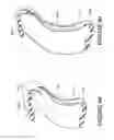 Fig. 51 - ORO-NASAL PATIENT INTERFACE