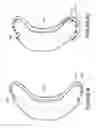 Fig. 52 - ORO-NASAL PATIENT INTERFACE