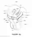 Fig. 66 - ORO-NASAL PATIENT INTERFACE
