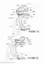 Fig. 71 - ORO-NASAL PATIENT INTERFACE
