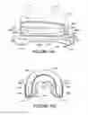 Fig. 74 - ORO-NASAL PATIENT INTERFACE